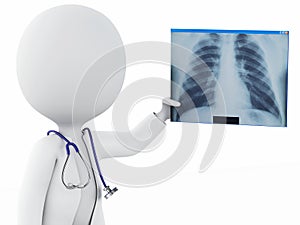 3d white people doctor with radiography