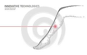 3D woman leg endovenous laser operation concept. Medical surgery veins varicose treatment female foot. Cosmetic hair