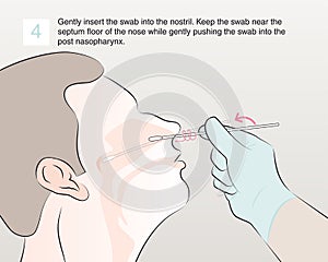4-insert the swab into the nostril