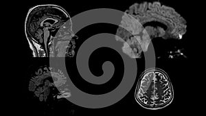 4K Brain MRI, head scans and tumor detection. Diagnostic medical tool. four different view brain.