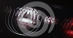 4k Doctors study head pet-ct skull brain scan X-ray film for analysis disease.