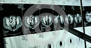 4k Doctors study skull brain X-ray film for analysis.health medical hospital.