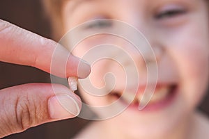 At 6 years old child has lost the baby tooth. The girl is holding the tooth in his hand