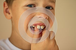 A 7-10 boy in a white T-shirt reels a falling tooth with his finger on a beige background