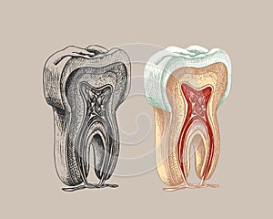 73_tooth structure, graphics