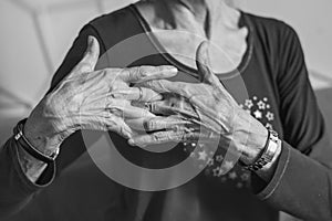 80 years old woman hands with ostheo arthritis, swollen hands and finger, joint inflammation