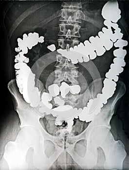 Abdomen radiography photo