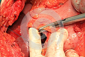 Abdominal arteries and veins