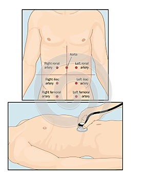 Abdominal auscultation