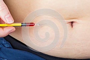 Abdominal insulin injection photo