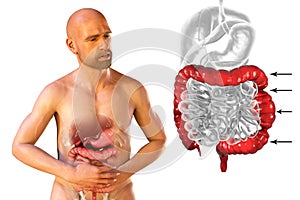 Abdominal pain and cramping in a male patient because of irritable bowel syndrome