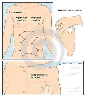 Abdominal percussion technique