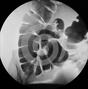 Abdominal x-ray