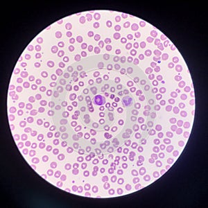 Abnomal neutrophil donut shape in leaf