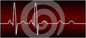 Abnormal EKG