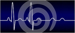 Abnormal EKG