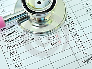 Abnormal high liver enzyme test result