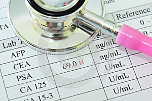 Abnormal high PSA test result