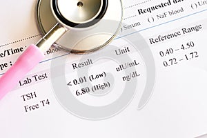 Abnormal thyroid hormone test result