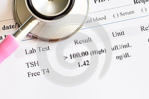 Abnormal thyroid hormone test result