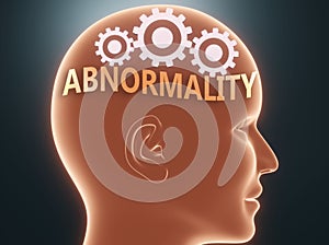 Abnormality inside human mind - pictured as word Abnormality inside a head with cogwheels to symbolize that Abnormality is what