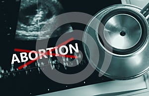 Abortion ban legal