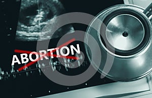 Abortion ban legal photo