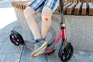 Abrasions, bruises on the knees of unrecognizable teenager with kick scooter. Life of teenagers