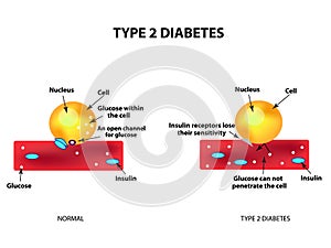 The absorption of glucose by the cell. Type 2 diabetes. Increase