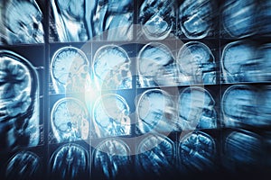 Abstract image with motion blur effect of MRI or magnetic resonance image of head or scull and brain scan