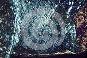 Abstract, polarizing micrograph showing details of an earthworm photo