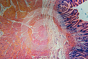 Cell microscopic- pyloric division stomach