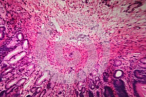 Cell microscopic- pyloric division stomach