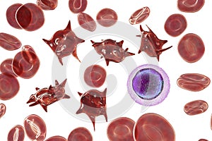 Acanthocytes, abnormal red blood cells with thorn-like projections