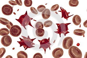 Acanthocytes, abnormal red blood cells with thorn-like projections photo