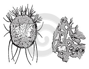 A-Acarus scabiei, B-Portion of epidermis, showing the burrows with their contained eggs, vintage engraving