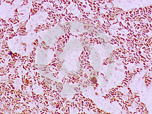 Acenetorbacter Baumanni