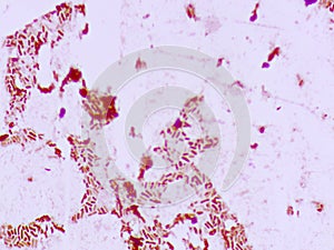 Acenetorbacter Baumanni