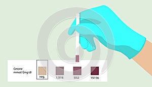 Acetone test. Medical express test. Ketones.