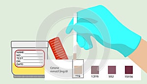 Acetone test. Medical express test. Ketones.