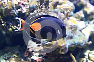 Achilles tang