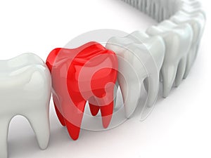 Aching tooth in row of healthy teeth.
