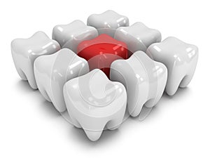 Aching tooth in row of healthy teeth