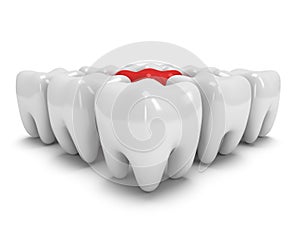Aching tooth in row of healthy teeth