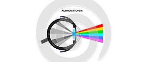 Achromatopsia vision deficiency