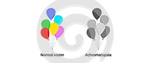 Achromatopsia vision deficiency