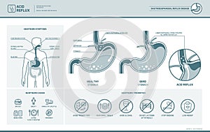 Acid reflux and heartburn infographic