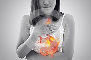 Acid Reflux photo