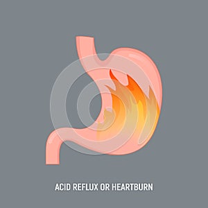 Acid stomach burn gastritis icon. GERD acidity stomach reflux heartburn ache