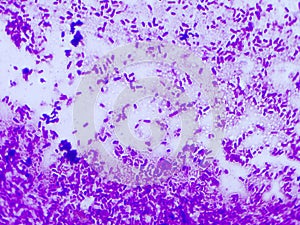 Acinetobacter baumannii